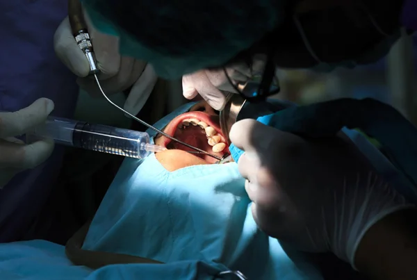 Minor Oral Surgery